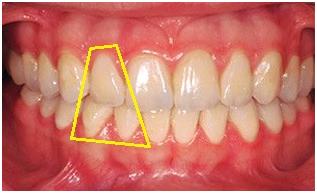dentista en gandia